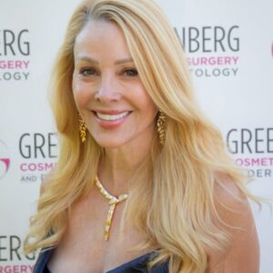 Smiling woman with long blonde hair and gold jewelry at a cosmetic surgery event.